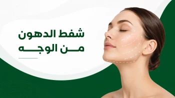 شفط الدهون من الوجه