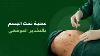 عملیة نحت الجسم باالتخدیر الموضعی