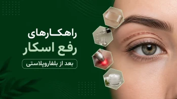 رفع اسکار بعد از بلفاروپلاستی