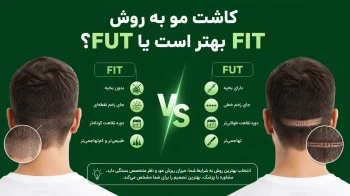 کاشت مو به روش FIT و FUT