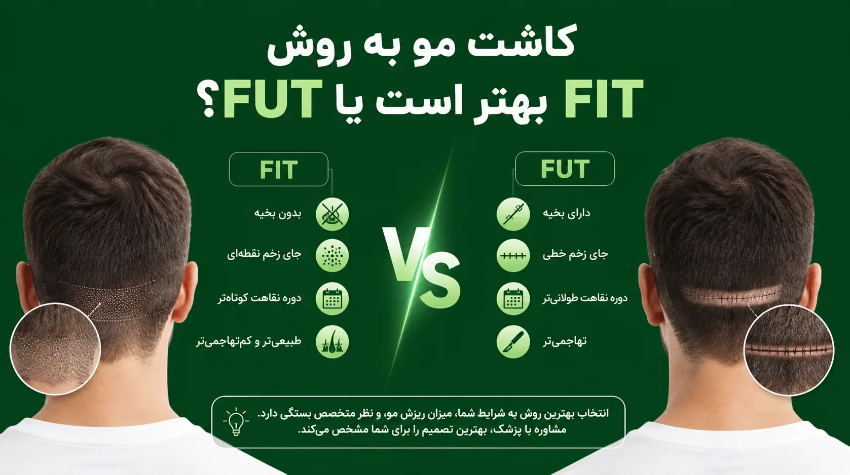 کاشت مو به روش FIT و FUT