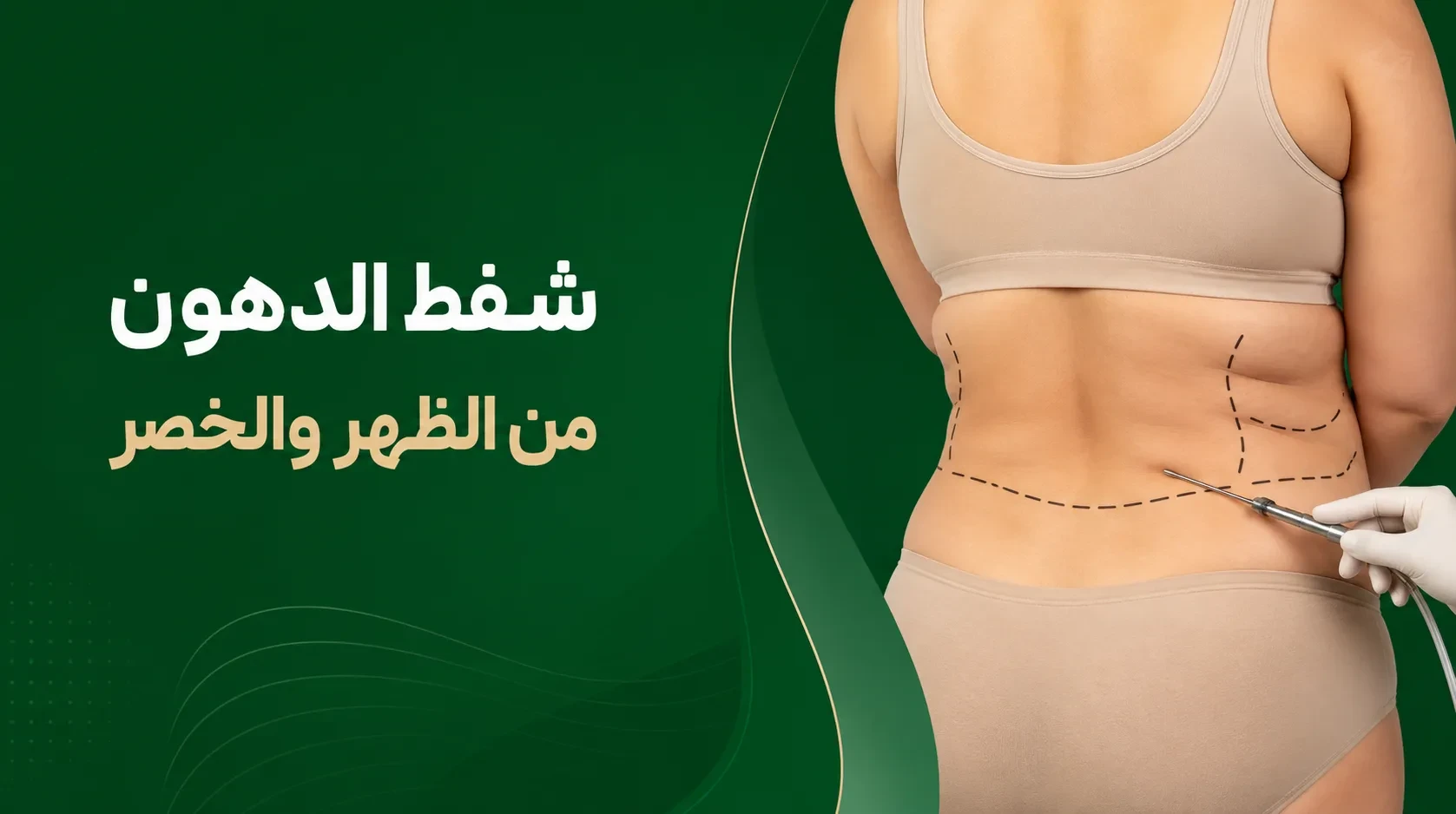 شفط الدهون من الظهر والخصر