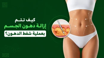 كيفية شفط الدهون من الجسم
