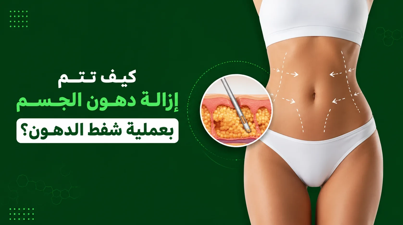 كيفية شفط الدهون من الجسم