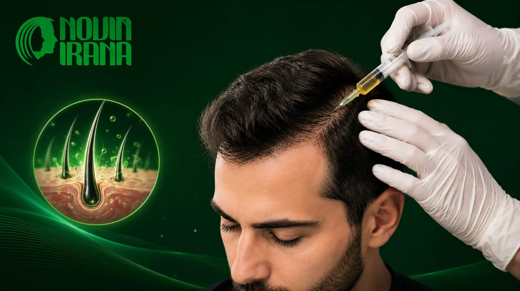 مزوتراپی مو در مشهد