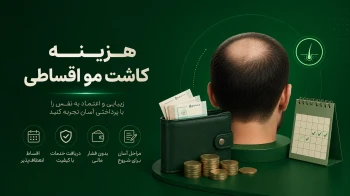 کاشت مو اقساطی
