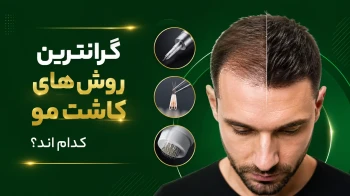 گرانترین روش کاشت مو