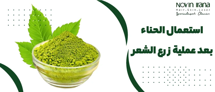 استعمال الحناء بعد عملية زرع الشعر