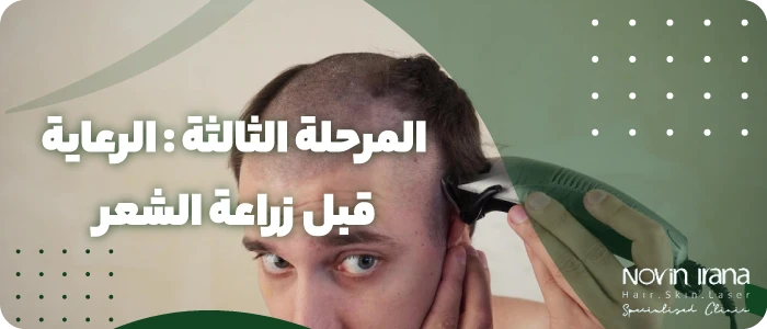 الرعاية قبل زراعة الشعر