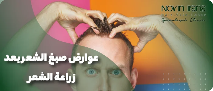 عوارض صبغ الشعر بعد زراعة الشعر