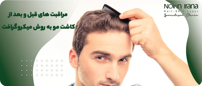 کاشت مو میکروگرافت