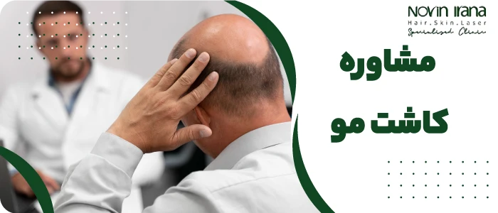 مشاوره کاشت مو