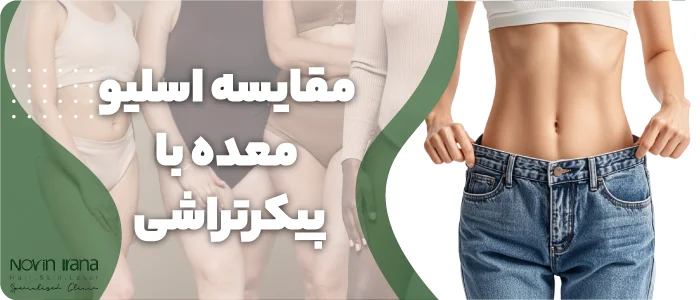 مقایسه اسلیو معده با پیکرتراشی