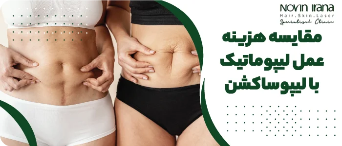 مقایسه هزینه عمللیپوماتیک با لیپوساکشن