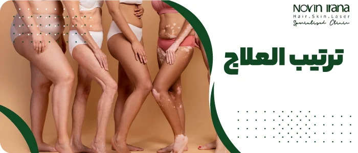 ترتيب العلاج