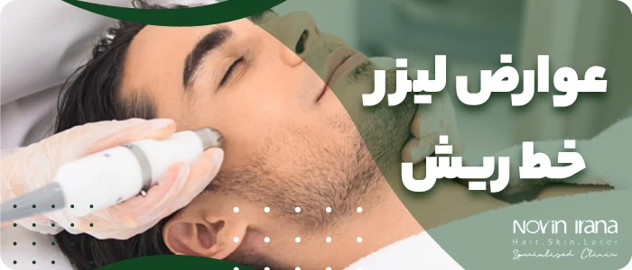 عوارض لیزر خط ریش