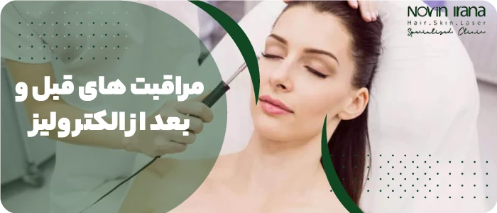 مرکز لیزر موهای سفید
