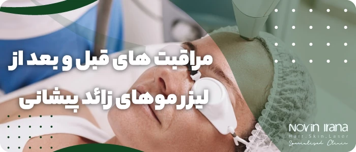 مراقبت های قبل و بعد از لیزر موهای زائد پیشانی
