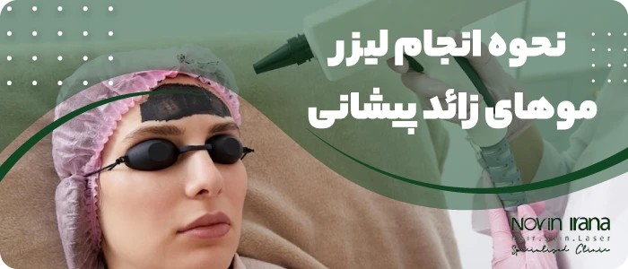 نحوه انجام لیزر موهای زائد پیشانی