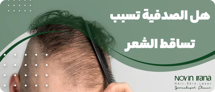 هل الصدفية تسبب تساقط الشعر