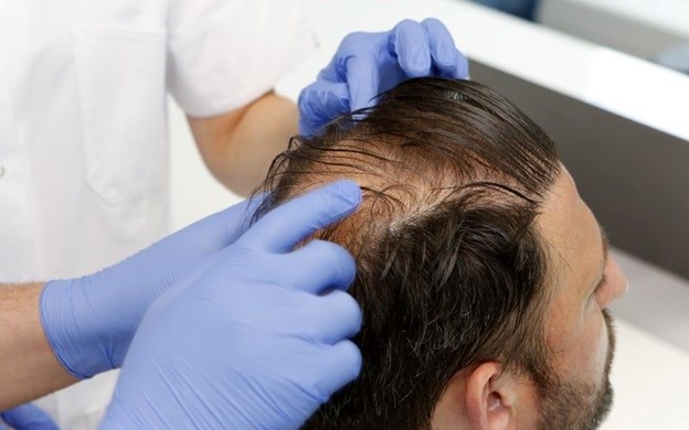 ما هي أعلى كثافة لزراعة الشعر؟