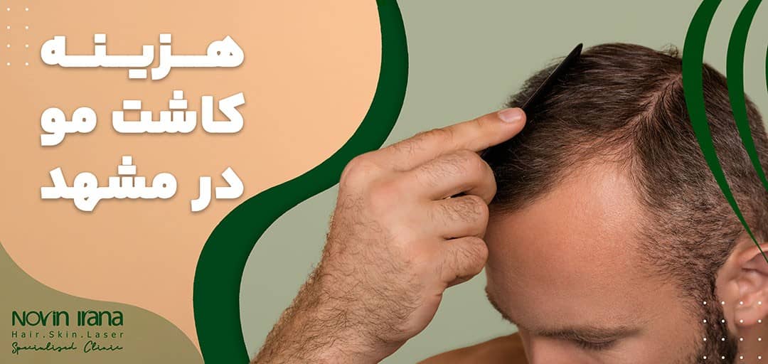 قیمت کاشت مو در مشهد