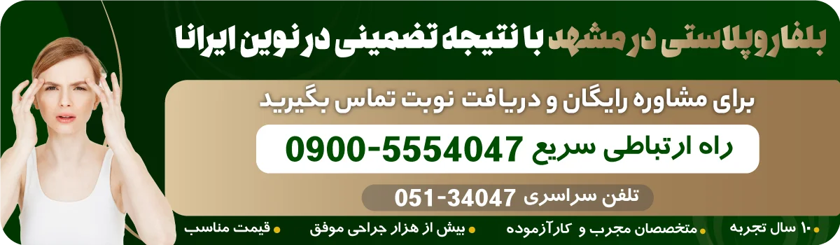  بلفاروپلاستی در مشهد