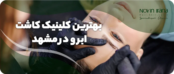 بهترین کلینیک کاشت ابرو در مشهد