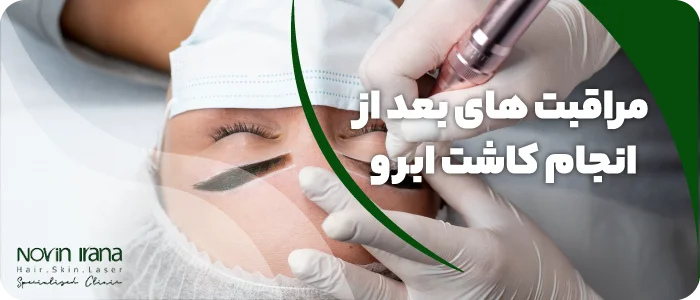 مراقبت های بعد از کاشت ابرو