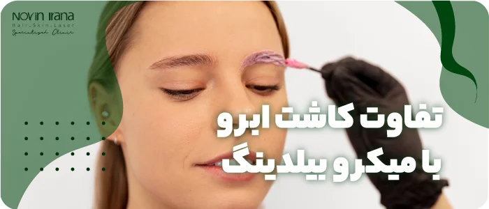 تفاوت کاشت ابرو با میکروبلیدینگ