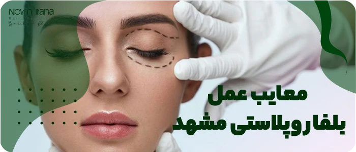 معایب عمل بلفاروپلاستی