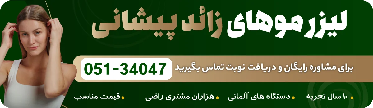 لیزر موی پیشانی در مشهد