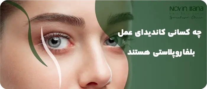 در مشهد بلفاروپلاستی برای چه افرادی توصیخ می شود؟