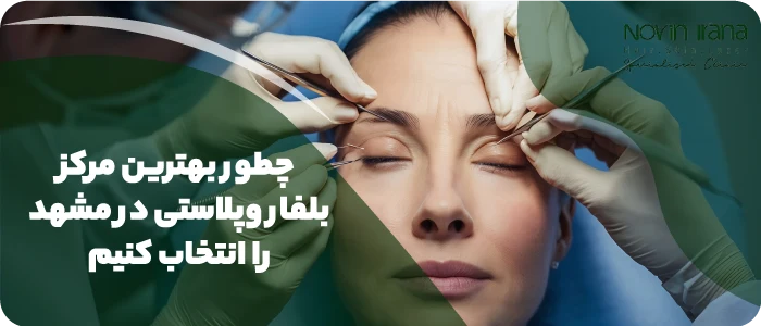 بهترین مرکز بلفاروپلاستی در مشهد