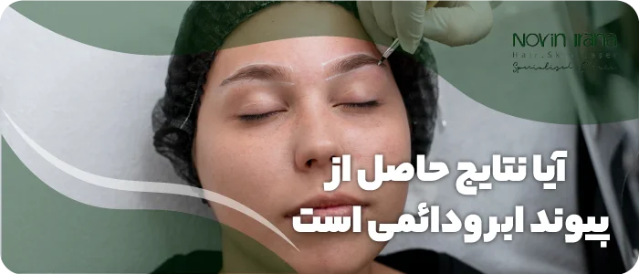 آیا نتایج پیوند ابرو دائمی است