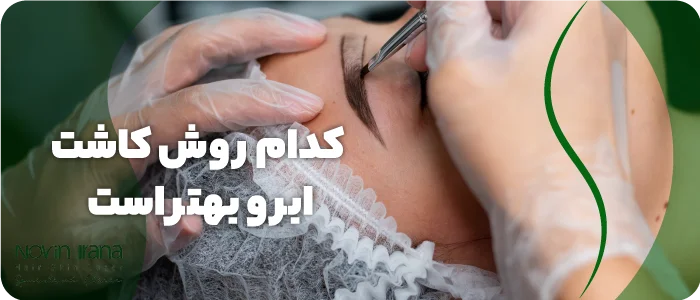 کدام روش کاشت ابرو بهتر است