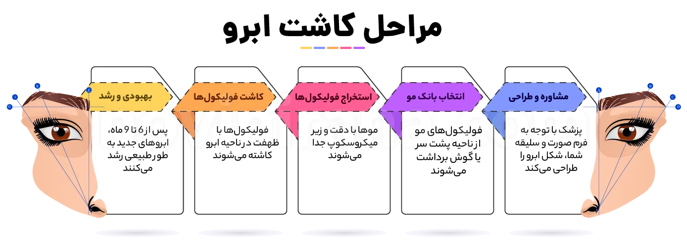 جدیدترین روش کاشت ابرو