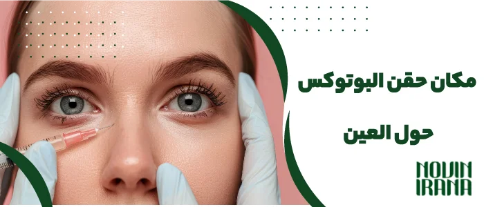 مكان حقن البوتوكس حول العين