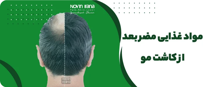 مواد غذایی مضر بعد از کاشت مو