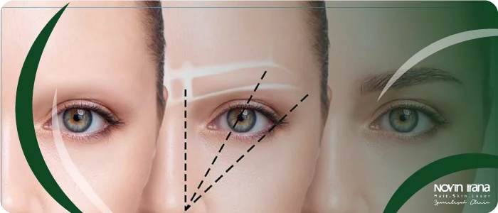  سوالات متداول در مورد ترمیم کاشت ابرو