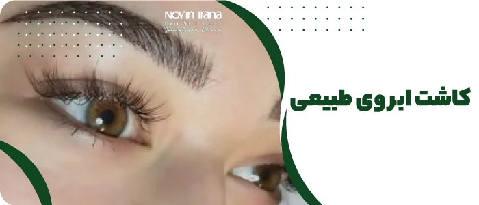 کاشت ابروی طبیعی