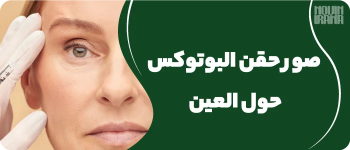 صور حقن البوتوكس حول العين