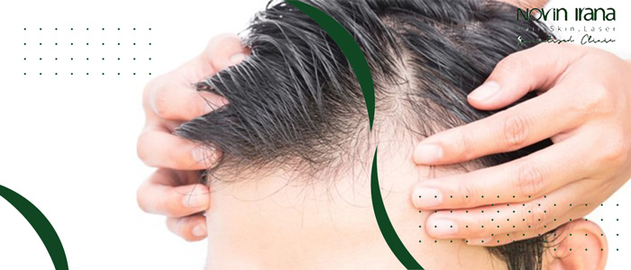 ما هی الفرق بين زراعة الشعر الطبيعي والاصطناعي