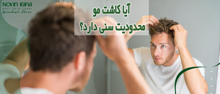 محدودیت سنی کاشت مو