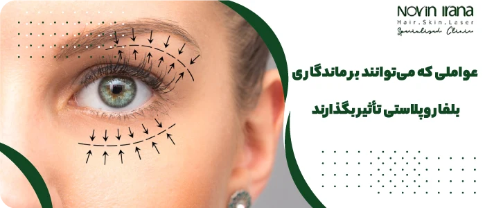 عوامل اثرگذار بر ماندگاری بلفاروپلاستی