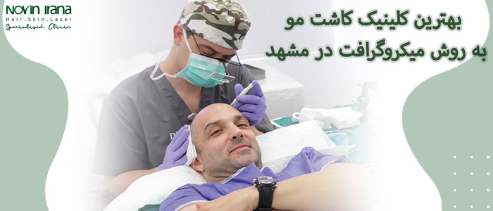 بهترین کلینیک کاشت مو به روش میکروگرافت در مشهد