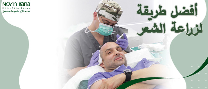أفضل طريقة لزراعة الشعر في إيران
