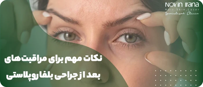 نکات مهم برای افزایش ماندگاری بلفاروپلاستی