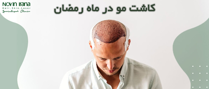 نکات کاشت مو در ماه رمضان