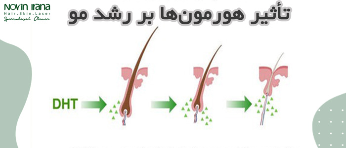 تأثیر هورمون‌ها بر رشد مو